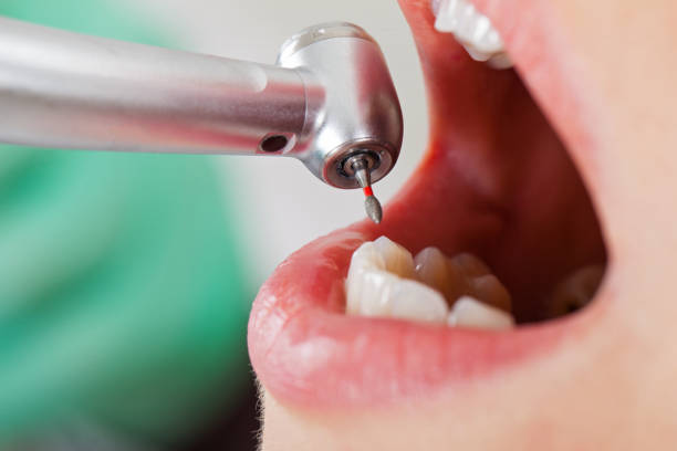 Best Urgent Tooth Repair  in Sultana, CA